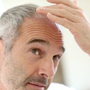 hair loss thinning aging baldness